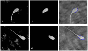 Fecondazione. Primo video 3-D di spermatozoi umani viventi